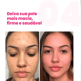 Kit 3 meses de tratamento Life Gummy Hair | Vitamina para cabelo, Pele e Unhas